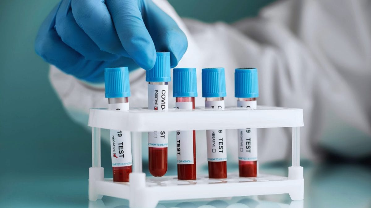 COVID PCR tests