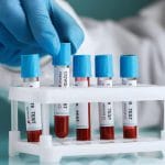 COVID PCR tests