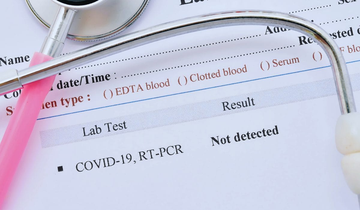 Why Speed Matters: The Impact of Rapid Testing on Public Health